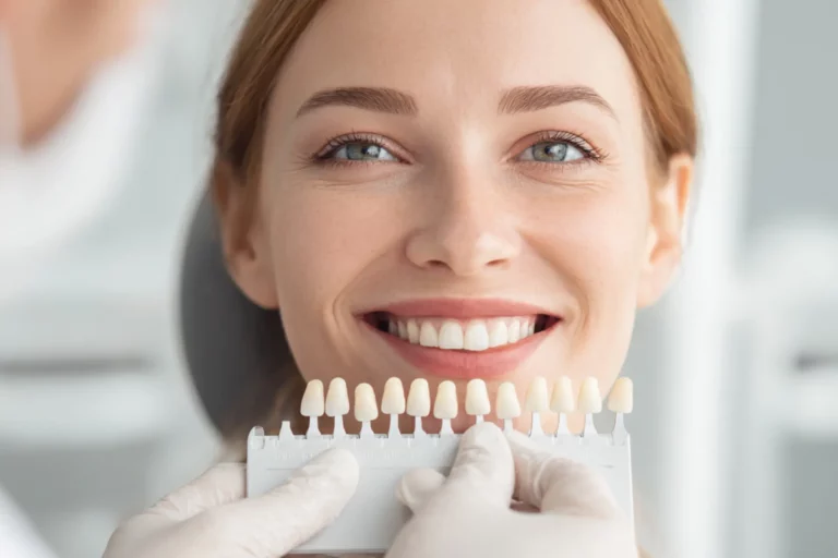 Close-up of a bright smile with dentist holding a veneer shade guide to match tooth color