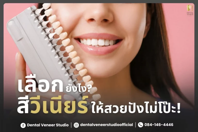 เลือกเฉดสีวีเนียร์ยังไง? ให้สวยปัง ไม่โป๊ะ!