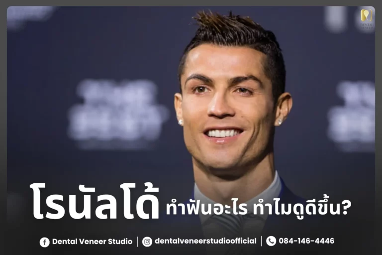 เบื้องหลังการเปลี่ยนแปลงฟันของโรนัลโด้คืออะไร?