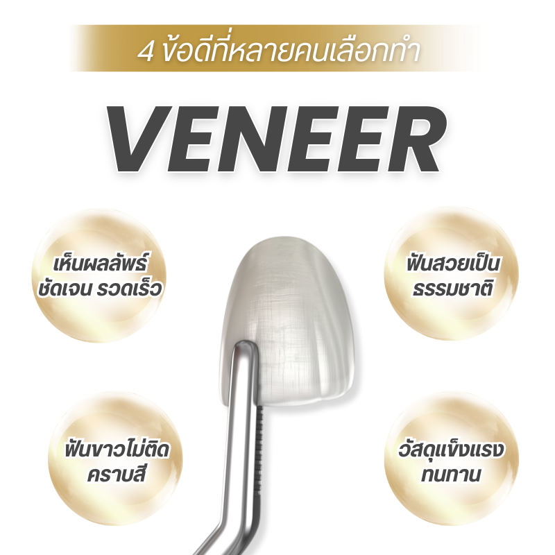 ข้อดีของการทำวีเนียร์