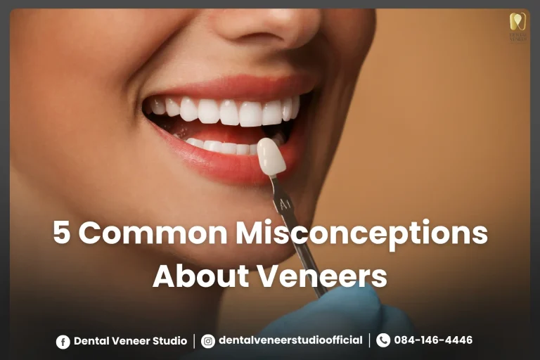 5 Common Misconceptions About Veneers You Shouldn’t Believe