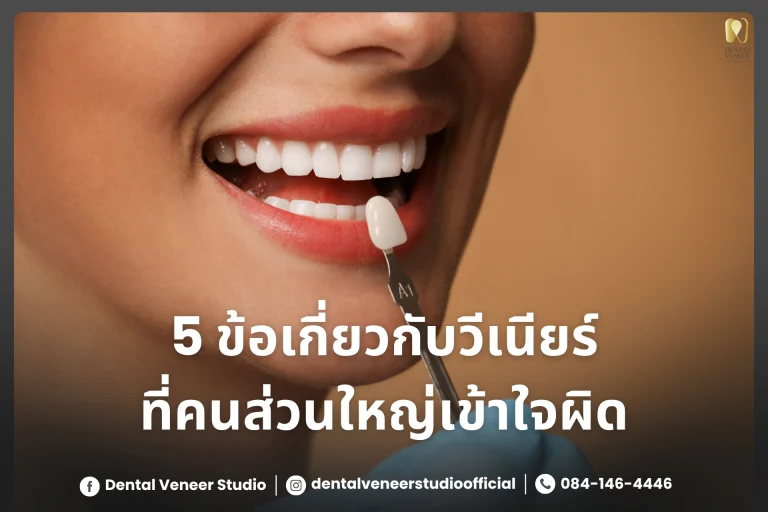 5 ข้อเกี่ยวกับวีเนียร์ที่คนส่วนใหญ่เข้าใจผิด