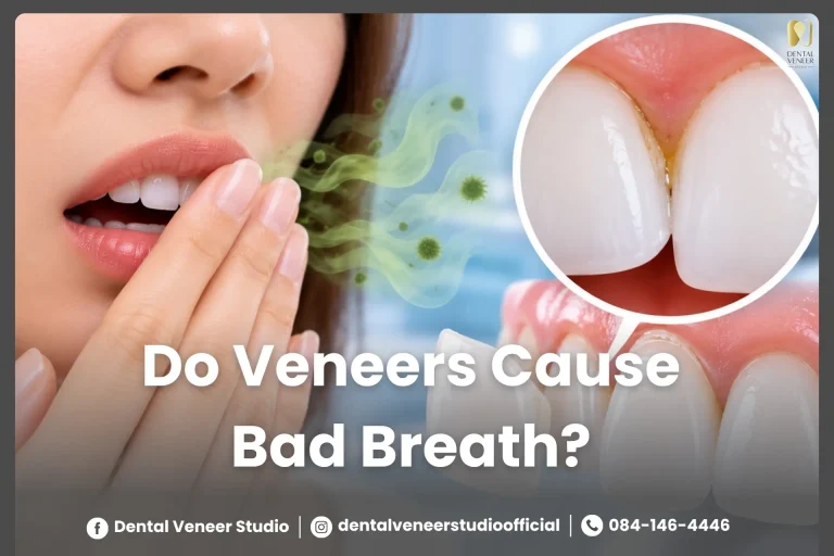 Do Veneers Cause Bad Breath? Here’s the Truth